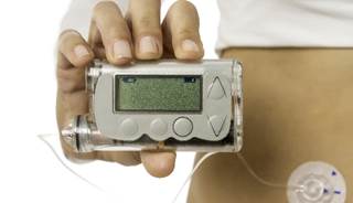 Most adults with T2D who received multiple daily injections saw a benefit in glycemic control after 24 weeks of continuous glucose monitoring. Most adults with T2D who received multiple daily injections saw a benefit in glycemic control after 24 weeks of continuous glucose monitoring.