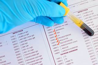 Severe anxiety was independently associated with poor quality of life in postmenopausal patients. Severe anxiety was independently associated with poor quality of life in postmenopausal patients.