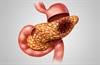 Hepatitis B Infection May Increase the Risk for Pancreatic Cancer Hepatitis B Infection May Increase the Risk for Pancreatic Cancer