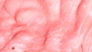 Patients who also had radiation therapy and/or chemotherapy had an elevated risk for heart and circulatory system disorders. Patients who also had radiation therapy and/or chemotherapy had an elevated risk for heart and circulatory system disorders.