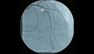 Ordering CT scans on young, otherwise healthy individuals may place a burden on the health care system. Ordering CT scans on young, otherwise healthy individuals may place a burden on the health care system.