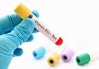 Low Vitamin B12 Levels Associated With Long-Term Metformin Use Low Vitamin B12 Levels Associated With Long-Term Metformin Use