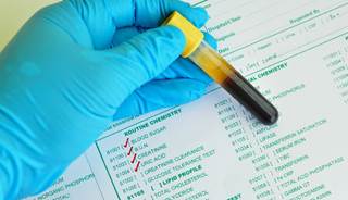 The use of combined GLP-1/DPP-4 medication therapy is not currently supported by American Diabetes Association guidelines. The use of combined GLP-1/DPP-4 medication therapy is not currently supported by American Diabetes Association guidelines.