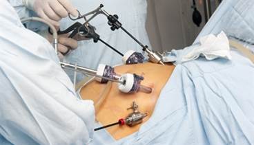 Gastric Bypass May Aid Muscle Strength, Physical Performance Gastric Bypass May Aid Muscle Strength, Physical Performance
