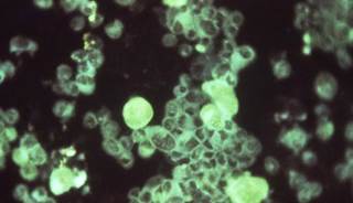Researchers found that nearly 5% of women with ctyomegalovirus had at least 3 risk factors for metabolic syndrome. <i>Image Credit: CDC/Dr. Craig Lyerla</i> Researchers found that nearly 5% of women with ctyomegalovirus had at least 3 risk factors for metabolic syndrome. <i>Image Credit: CDC/Dr. Craig Lyerla</i>