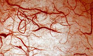 It appears that neuropathy is not a factor in impairing microvascular endothelium-dependent vasodilation. It appears that neuropathy is not a factor in impairing microvascular endothelium-dependent vasodilation.