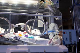 A moderate increase in perinatal mortality in deliveries after 37 weeks was found even in women with gestational diabetes not treated with insulin. A moderate increase in perinatal mortality in deliveries after 37 weeks was found even in women with gestational diabetes not treated with insulin.