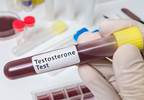 Long-Term Testosterone Treatment Reduced HbA1c in Men With Hypogonadism and Type 2 Diabetes Long-Term Testosterone Treatment Reduced HbA1c in Men With Hypogonadism and Type 2 Diabetes