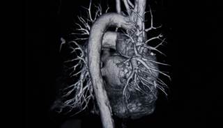 Researchers found that high levels of dietary potassium are associated with reduced blood pressure. Researchers found that high levels of dietary potassium are associated with reduced blood pressure.