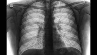 Researchers found that diagnostic accuracy via cell phone app was on par with traditional digital imaging and internet-based workstation viewing. Researchers found that diagnostic accuracy via cell phone app was on par with traditional digital imaging and internet-based workstation viewing.