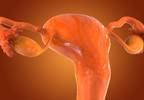Testosterone Therapy Increases Live Birth Rates in IVF Testosterone Therapy Increases Live Birth Rates in IVF