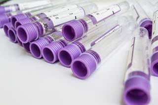 The mean number of insulin injections per day was 3.7. The mean number of insulin injections per day was 3.7.