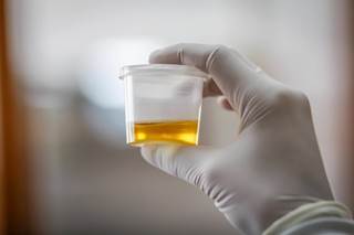 Patients in the lowest quartiles of urinary uromodulin had increased risks of end-stage renal disease and rapid kidney function decline. Patients in the lowest quartiles of urinary uromodulin had increased risks of end-stage renal disease and rapid kidney function decline.