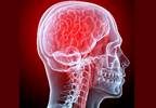 Migraine Management in Female Reproduction Migraine Management in Female Reproduction