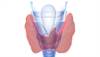 Silent Thyroiditis Risk Increased With Lithium Therapy for Bipolar Disorder Silent Thyroiditis Risk Increased With Lithium Therapy for Bipolar Disorder