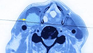 Researchers attribute this variation to "widely divergent local beliefs and practice patterns" related to thyroid nodules and cancer care. Researchers attribute this variation to "widely divergent local beliefs and practice patterns" related to thyroid nodules and cancer care.