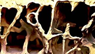 Incidence of osteoporosis is higher in women, but the risk of mortality is often higher in men. Incidence of osteoporosis is higher in women, but the risk of mortality is often higher in men.