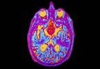 New Research Highlights Possible Genetic Cause of Cushing's Disease New Research Highlights Possible Genetic Cause of Cushing's Disease