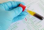 Liraglutide Does Not Increase Risk for Acute Pancreatitis in Type 2 Diabetes Liraglutide Does Not Increase Risk for Acute Pancreatitis in Type 2 Diabetes