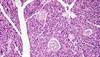 Semaglutide Improved Beta-Cell Function and Glycemic Control in Type 2 Diabetes Semaglutide Improved Beta-Cell Function and Glycemic Control in Type 2 Diabetes