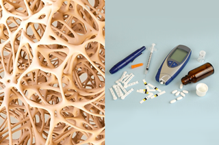 Anastasia D. Dede, MD, MSc, provides insight into managing concomitant type 2 diabetes and osteoporosis. Anastasia D. Dede, MD, MSc, provides insight into managing concomitant type 2 diabetes and osteoporosis.