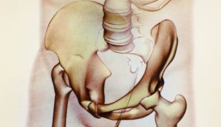 Female sex was associated with lower hip but not spine BMD. Female sex was associated with lower hip but not spine BMD.