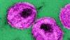 BMD Loss Slowed With Delayed Antiretroviral Therapy in HIV BMD Loss Slowed With Delayed Antiretroviral Therapy in HIV