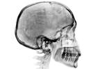 Causes of Abnormal Menstruation: Sports-Related Concussion and Non-Head Injuries Causes of Abnormal Menstruation: Sports-Related Concussion and Non-Head Injuries