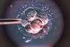 Ethical Considerations in Publicly Funded Fertility Treatment Ethical Considerations in Publicly Funded Fertility Treatment
