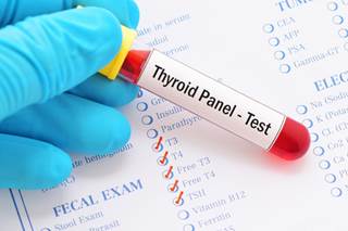 The main underlying cause of central congential hypothyroidism is combined congenital pituitary hormone deficiency. The main underlying cause of central congential hypothyroidism is combined congenital pituitary hormone deficiency.