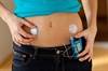Insulin Pump Associated With Fewer Complications Than Injections in Children, Adolescents Insulin Pump Associated With Fewer Complications Than Injections in Children, Adolescents