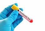 BMD and Parathyroid Hormone Levels in Pseudohypoparathyroidism 1B BMD and Parathyroid Hormone Levels in Pseudohypoparathyroidism 1B