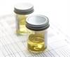 Change in Urine Albumin-to-Creatinine Ratio May Be a Prognostic Indicator in T2D Change in Urine Albumin-to-Creatinine Ratio May Be a Prognostic Indicator in T2D