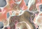 Prolonged Antiresorptive Activity With Zoledronate in Postmenopausal Osteopenia Prolonged Antiresorptive Activity With Zoledronate in Postmenopausal Osteopenia