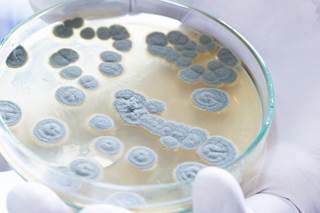 Use of contaminated product could result in infection, especially for immunocompromised patients. Use of contaminated product could result in infection, especially for immunocompromised patients.