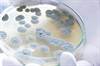 Voluntary Recall of Diabetes Drug Due to Possible Microbial Contamination Voluntary Recall of Diabetes Drug Due to Possible Microbial Contamination
