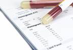 Canakinumab Does Not Appear to Prevent Diabetes Onset Canakinumab Does Not Appear to Prevent Diabetes Onset