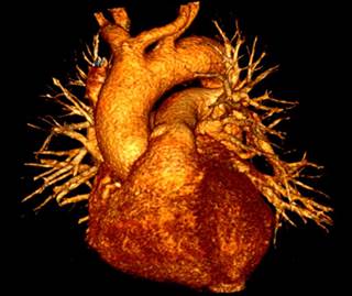 Severe hypoglycemia is associated with a high absolute risk of mortality and cardiovascular events in patients with type 2 diabetes. Severe hypoglycemia is associated with a high absolute risk of mortality and cardiovascular events in patients with type 2 diabetes.