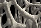 Prevention of Bone Mineral Density Loss Needed in Epilepsy Prevention of Bone Mineral Density Loss Needed in Epilepsy