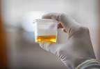 Identifying Risk for Microalbuminuria in Children With Type 1 Diabetes Identifying Risk for Microalbuminuria in Children With Type 1 Diabetes