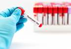 Levothyroxine in Pregnancy Did Not Affect Neonatal Admission Rates Levothyroxine in Pregnancy Did Not Affect Neonatal Admission Rates