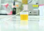 Urinary Albumin-to-Creatinine Ratio Aids CV Risk Assessment in T2D Urinary Albumin-to-Creatinine Ratio Aids CV Risk Assessment in T2D