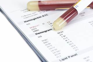 A wide range of both neuroglycopenic and adrenergic symptoms of hypoglycemia were reported among subjects. A wide range of both neuroglycopenic and adrenergic symptoms of hypoglycemia were reported among subjects.