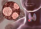 Higher Risk of Aging-Related Morbidities in Thyroid Cancer Survivors Higher Risk of Aging-Related Morbidities in Thyroid Cancer Survivors