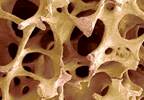Trabecular Bone Morphology Changes May Predict Bone Strength in Girls Trabecular Bone Morphology Changes May Predict Bone Strength in Girls