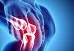 Effect of Intra-Articular Depot Betamethasone on Insulin Resistance in T2D Effect of Intra-Articular Depot Betamethasone on Insulin Resistance in T2D