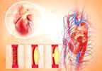 Duration of Prediabetes, Diabetes Independently Associated With Subclinical Atherosclerosis, Cardiac Dysfunction Duration of Prediabetes, Diabetes Independently Associated With Subclinical Atherosclerosis, Cardiac Dysfunction