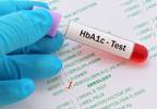 American College of Physicians Releases 4 Guidelines for HbA1c Targets in T2D American College of Physicians Releases 4 Guidelines for HbA1c Targets in T2D