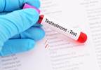 Differential Changes in Total Testosterone Levels Found in Schizophrenia Differential Changes in Total Testosterone Levels Found in Schizophrenia