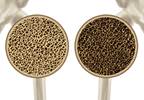 Abatacept May Improve Femoral Neck Bone Mineral Density in Rheumatoid Arthritis Abatacept May Improve Femoral Neck Bone Mineral Density in Rheumatoid Arthritis